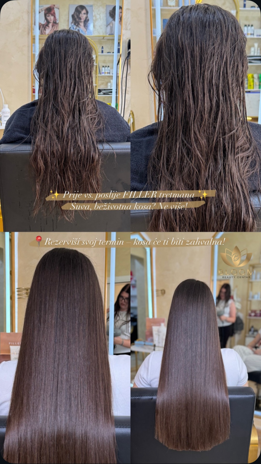 Bloom Beauty Centar #podgorica Laserska epilacija Filler tretman za njegu kose
