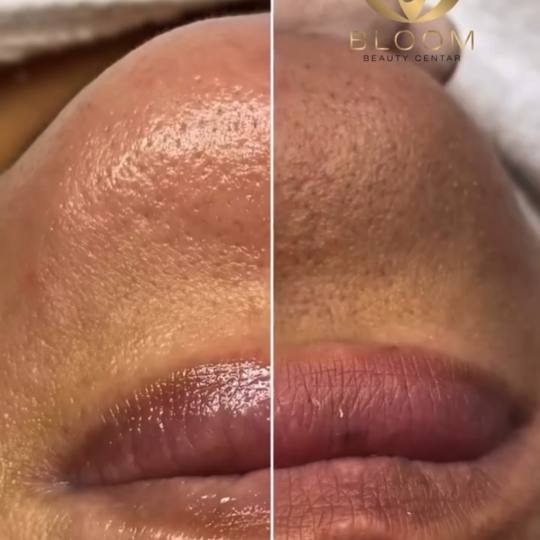 Bloom Beauty Centar usluga