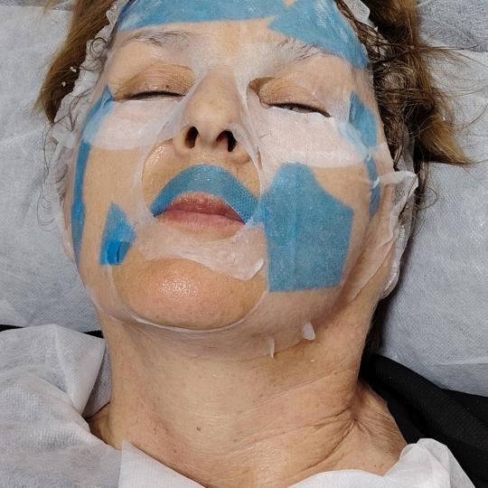 Face glow and nails #podgorica Tretman lica Collagen film Tretman lica kolagen nitima + plis kolagen