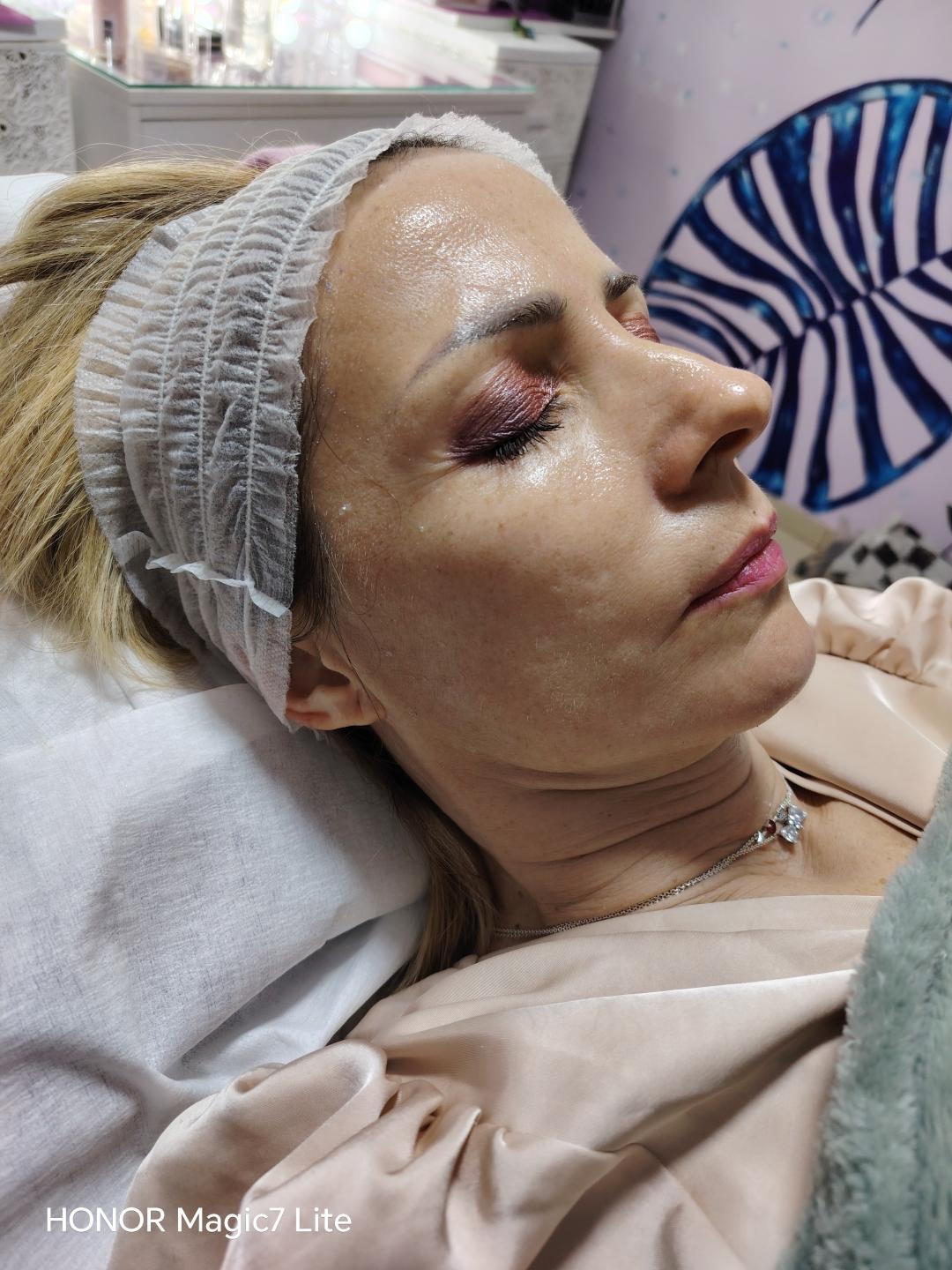 Face glow and nails #podgorica Tretman lica Mix tretmana