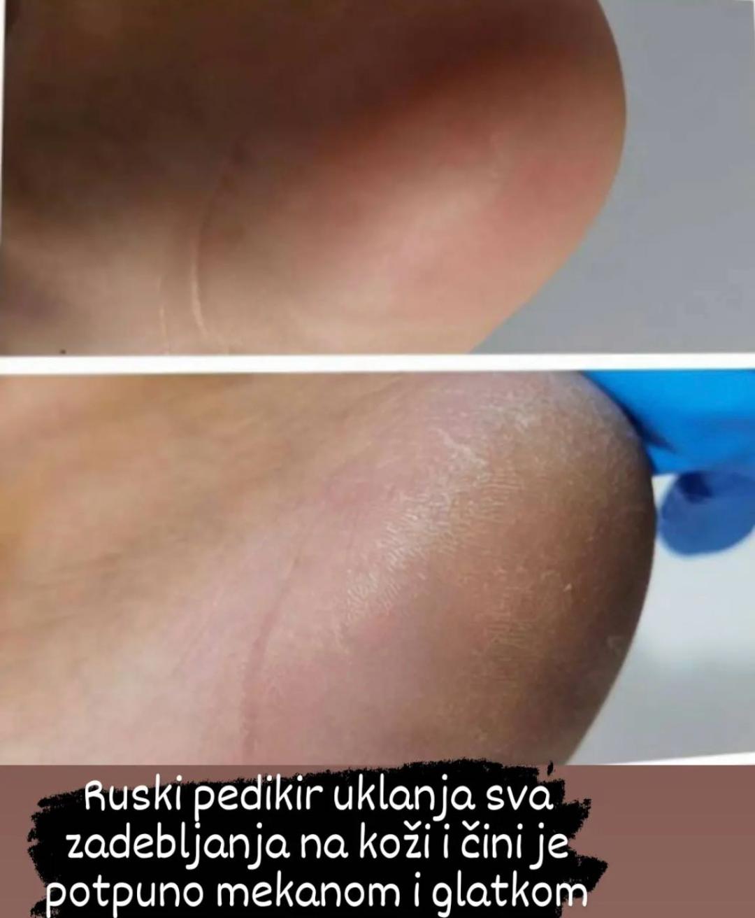 Krasota #niksic Estetski pedikir Ruski pedikir + trajni lak