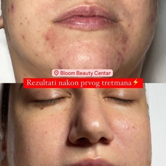 Bloom Beauty Centar usluga