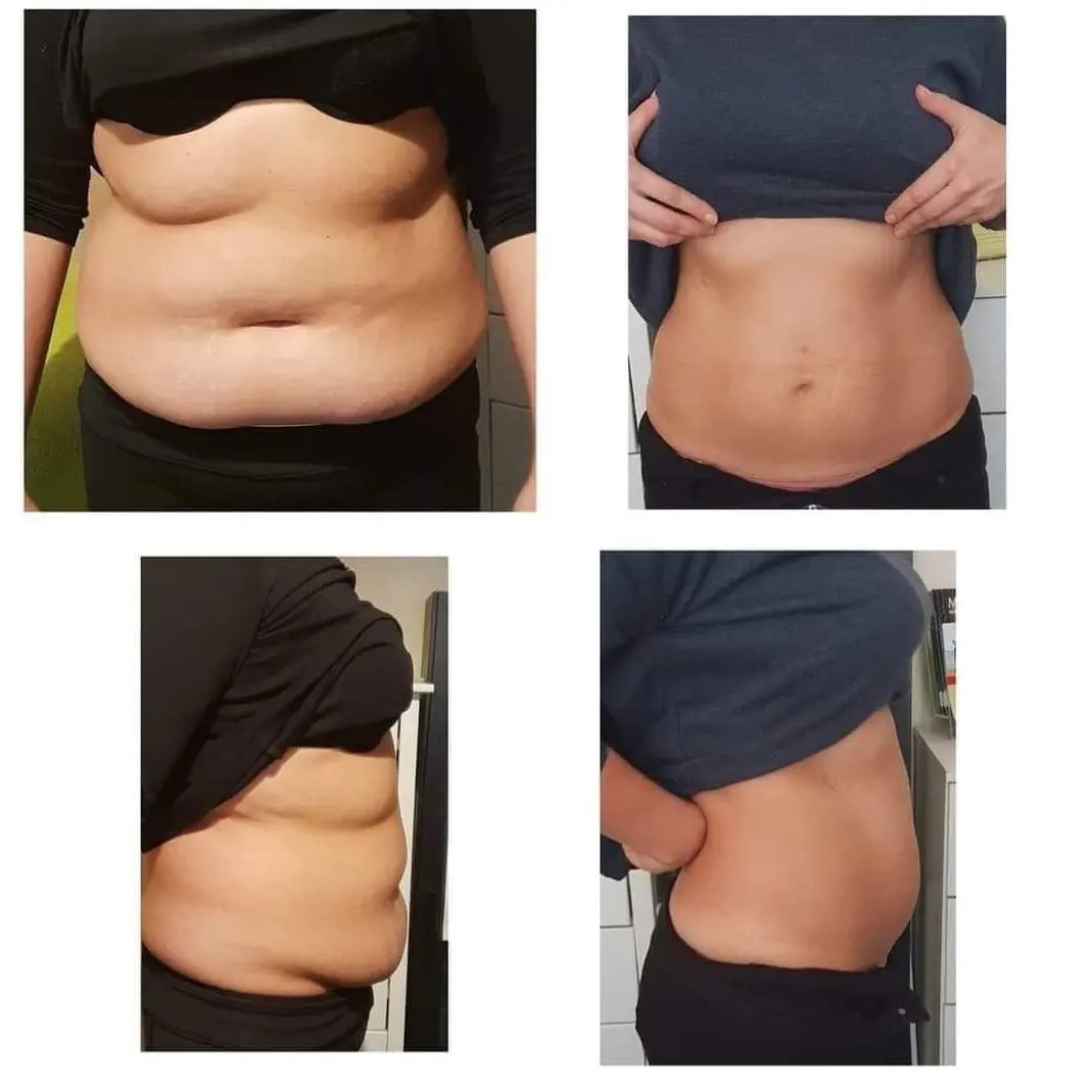 Modni studio Maja #podgorica Tretmani tijela Velashape tretman - noge + gluteus