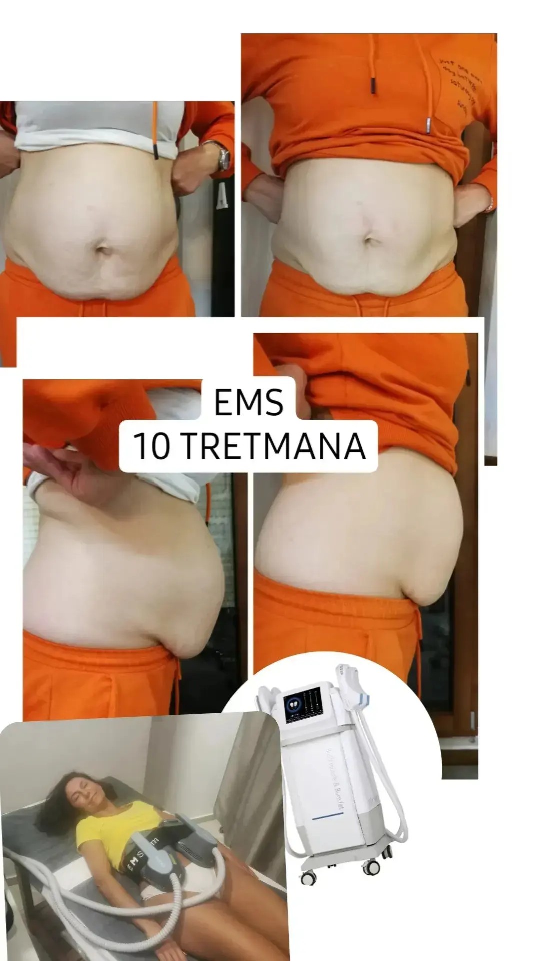 Modni studio Maja #podgorica Tretmani tijela EMS tretman - 30 minuta