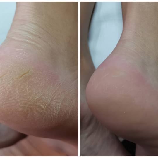 Ceca Beauty Nails Bauk #tivat